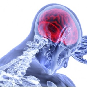 Những thông tin cần biết về bệnh học đột quỵ não